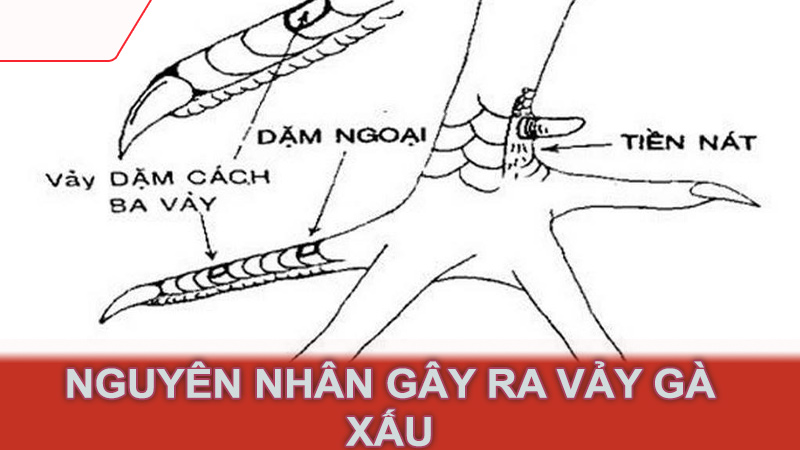 Nguyên nhân gây ra vảy gà xấu